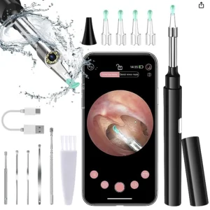 Ear Wax Removal Camera with HD Endoscope
